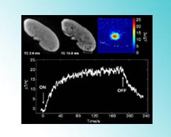 MRI temperature mapping in real time